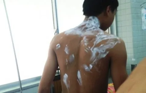 Five people suffer acid burns in HCMC