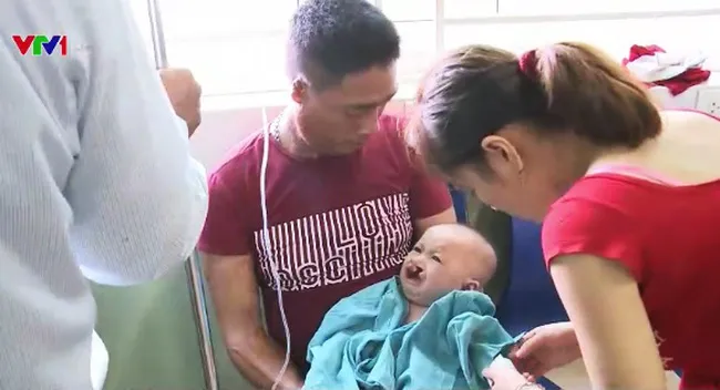 Free Cleft lip and palate Surgery