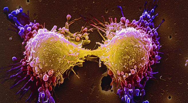 Cell therapy to treat cancer