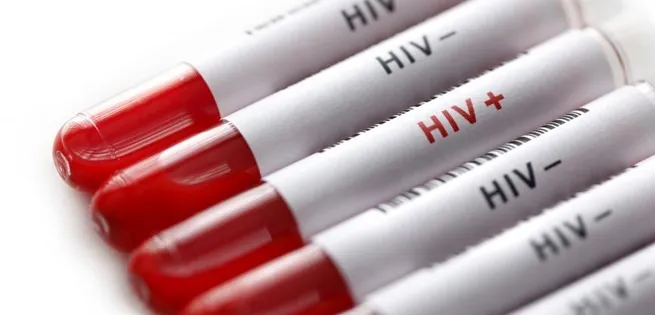 Vietnam keeps rate of new HIV cases lower 0.3 percent