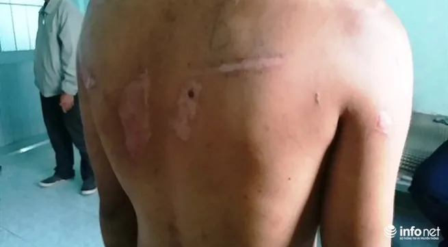 Housemaid severely beaten in Gia Lai