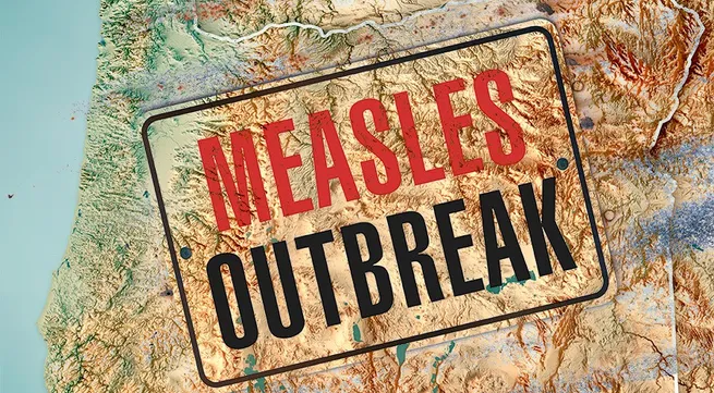 Washington declares emergency for measles outbreak