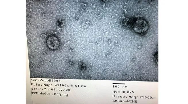 Vietnam successfully isolates new coronavirus
