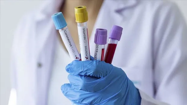 Brunei reports 134 COVID-19 cases as of April 3