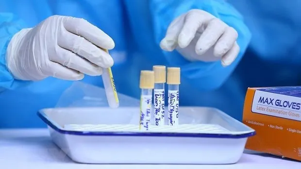 Another COVID-19 patient dies, raising death toll to 17