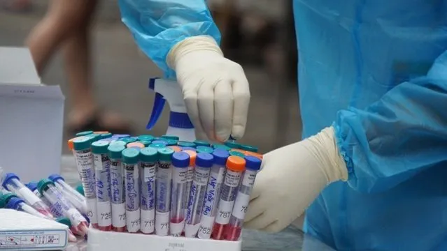 Vietnam logs 135 new COVID-19 infections on June 21 afternoon