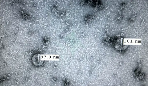 Virus divided into two different groups: scientists