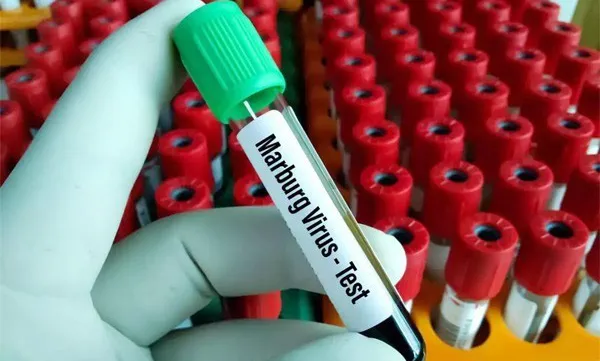 Ministry urges prevention of Marburg virus from entering Vietnam