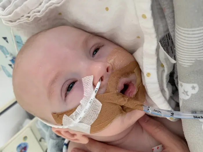 Bùng phát tình trạng ngộ độc botulinum ở trẻ sơ sinh tại Mỹ