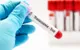 Ngày Thalassemia Thế giới 2025: Chung tay vì một thế hệ khỏe mạnh