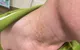 Phát hiện thêm ca bệnh giun rồng tại Phú Thọ