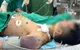 Biến chứng thủy đậu nguy kịch: Một ca xin về, một ca vẫn thở máy