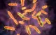 Tìm ra ‘thủ phạm’ không thể ngờ gây bệnh nhiễm khuẩn Salmonella tại Mỹ