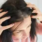 Căng thẳng có khiến tóc bạc không?