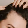 Điều gì xảy ra với mái tóc của phụ nữ trong thời kỳ mãn kinh?