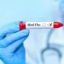 Ca nhiễm virus H5N2 tử vong do nhiều yếu tố
