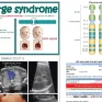 Bệnh DiGeorge được khuyến cáo sàng lọc cho thai phụ