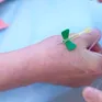 Thêm hy vọng mới cho bệnh nhân ung thư giai đoạn cuối