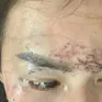 Khởi tố vụ án người phụ nữ bị tạt axit, xăm lên mặt do ghen tuông