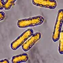 Mỹ ghi nhận đợt bùng phát vi khuẩn Listeria liên quan đến thực phẩm chế biến sẵn