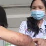 Xuất hiện sứa lửa gây nguy hiểm tại biển Nha Trang