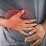 Những loại thực phẩm gây hại cho gan cần lưu ý