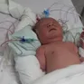 Giấc mơ lớn lên còn dang dở vì trái tim không lành lặn của bệnh nhi 2 tháng tuổi