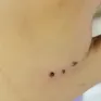Vết cắn nhỏ - hiểm họa lớn từ chuột