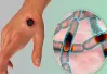 Thái Lan ghi nhận ca tử vong đầu tiên do bệnh than sau 30 năm, cảnh báo không thể chủ quan!